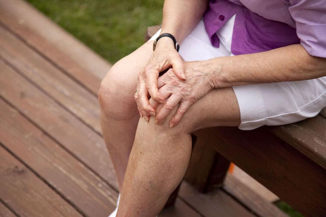 Osteoartrite do joelho é comum em mulheres mais velhas