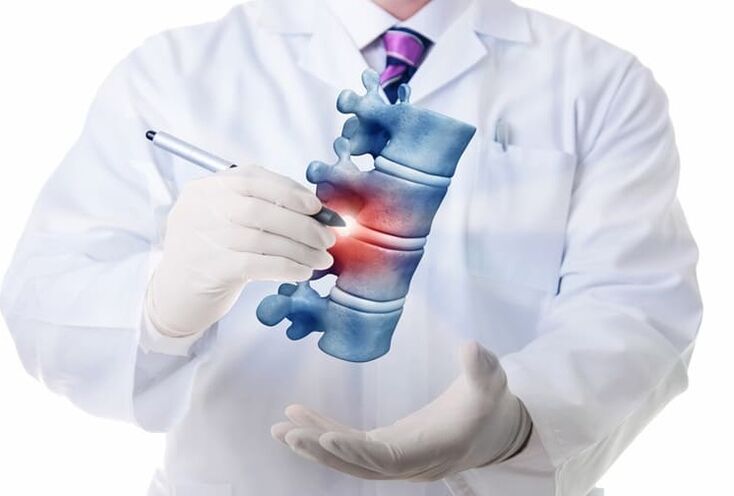 lesões espinhais devido à osteocondrose torácica
